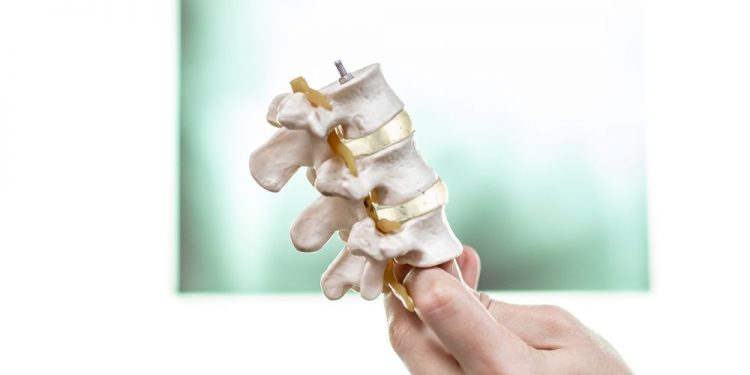 Osteosarcoma Symptoms