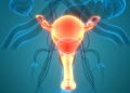 What is a Uterine Cyst?