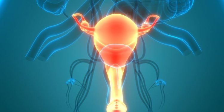 What is a Uterine Cyst?