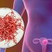 Uterine Polyps Symptoms