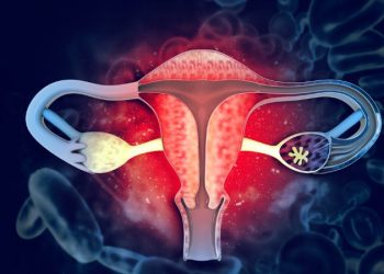 Uterine Polyps Cancer Symptoms