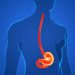 What is an Esophageal Web?