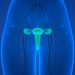 Advanced Uterine Cancer Symptoms