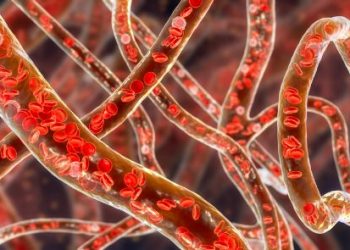 Chronic Myelogenous Leukemia