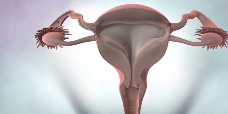 Uterine Cancer Stages