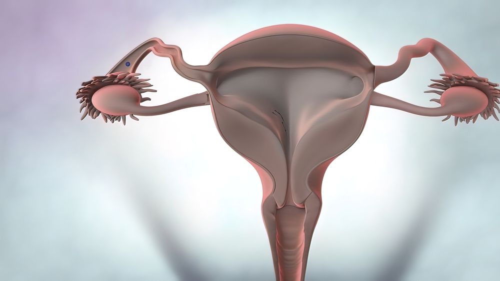 uterine-cancer-stages-news185