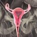 What is the Uterine Cervix?
