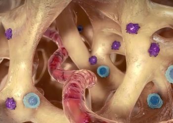 Pain Under Breast Bone Above Stomach