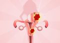 Thick Uterine Lining