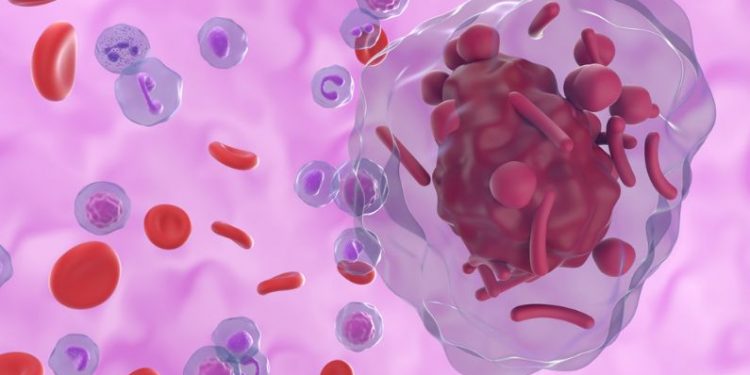 Leukaemia – Causes and Treatments