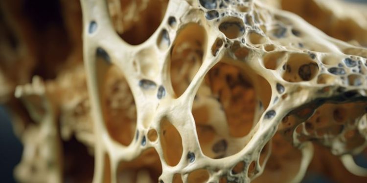 Osteogenic Sarcoma in Children