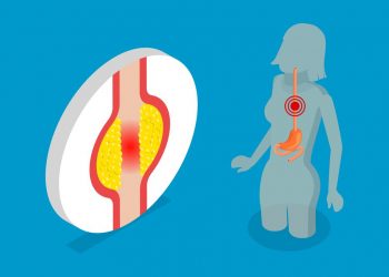 Symptoms of Oesophageal Cancer