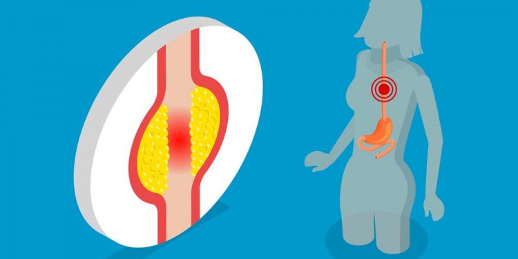Symptoms of Oesophageal Cancer