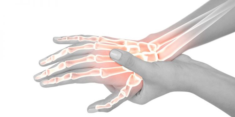 Ewing Sarcoma in Children
