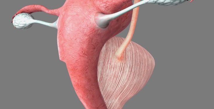 What You Should Know About Uterine Polyps