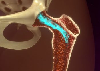 Blood and Bone Marrow Symptoms