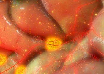 Hodgkin Lymphoma Treatments