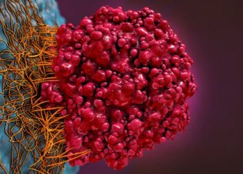 Hodgkin Lymphoma Staging