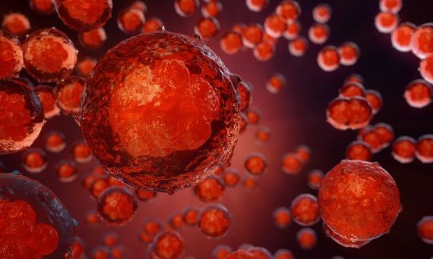 What is a Soft Tissue Sarcoma?