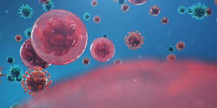 Synovial Sarcoma Treatment