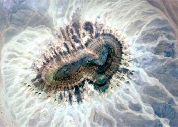 Glioblastoma Stage 4 – What to Expect