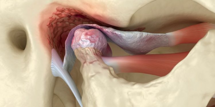 Non Cancerous Bone Marrow Disorders