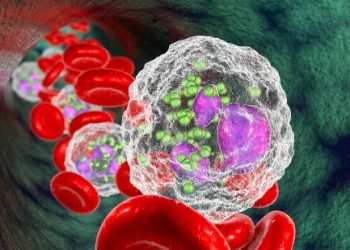 Metastatic Carcinoma