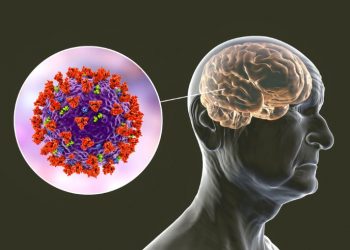 Glioblastoma Multiforme Full Form
