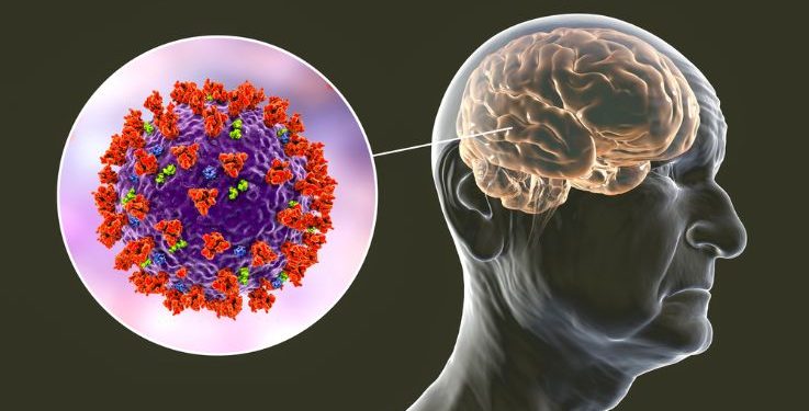 Glioblastoma Multiforme Full Form