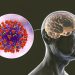 Glioblastoma Multiforme Full Form
