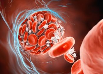 Diffuse Large B-Cell Lymphoma