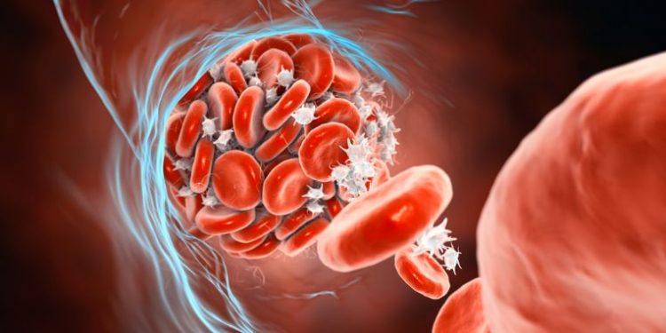 Diffuse Large B-Cell Lymphoma