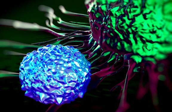 Hodgkin’s Lymphoma Symptoms and Tests