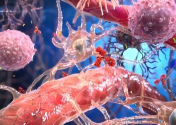 Cervical Adenocarcinoma