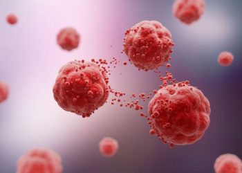 Prostate Adenocarcinoma