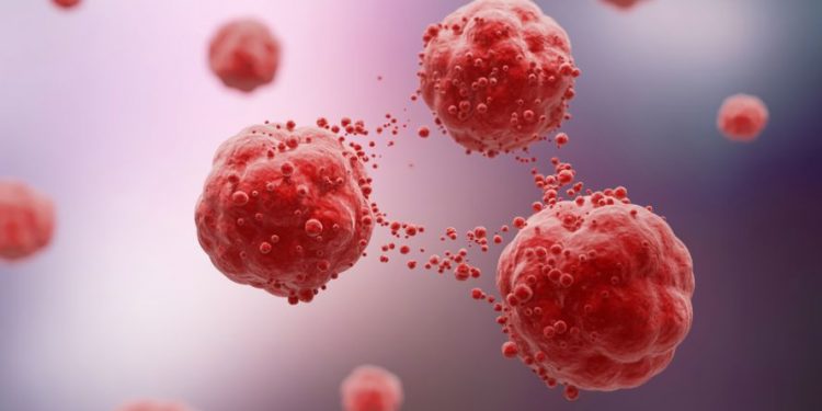 Prostate Adenocarcinoma