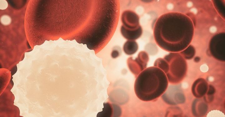 How a Biopsy Can Help Diagnose Invasive Adenocarcinoma