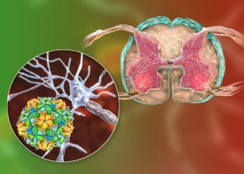 Glioblastoma Multiforme