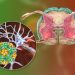 Glioblastoma Multiforme