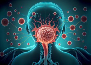 Glioblastoma Treatments