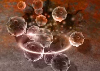 What is Bone Metastasis?