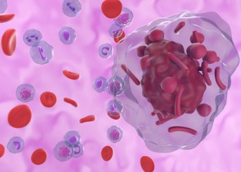 Non Hodgkin’s Lymphoma