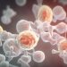 What Is a Weakly Differentiated Adenocarcinoma?