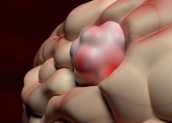 Glioblastoma Multiforme