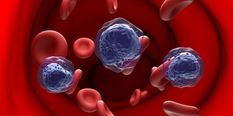 What is Hodgkin’s Disease?