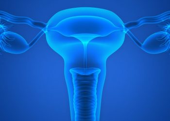 Ovarian Cancer Symptoms