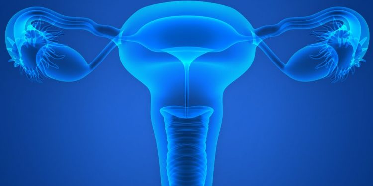 Ovarian Cancer Symptoms