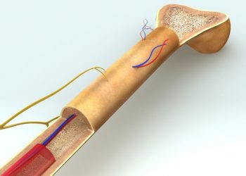 Multiple Myeloma Treatment