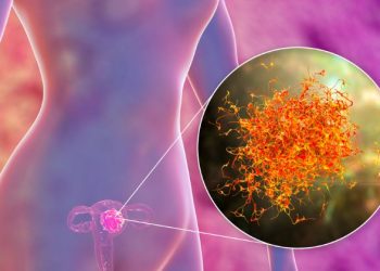 Uterine Cancer Treatment