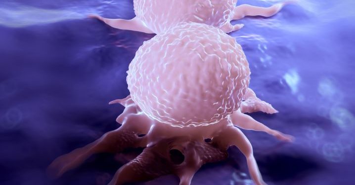 What You Should Know About Vulvar Cancer